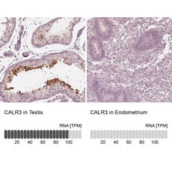 Calreticulin-2/CALR3 Antibody, Novus Biologicals:Antibodies:Primary Antibodies